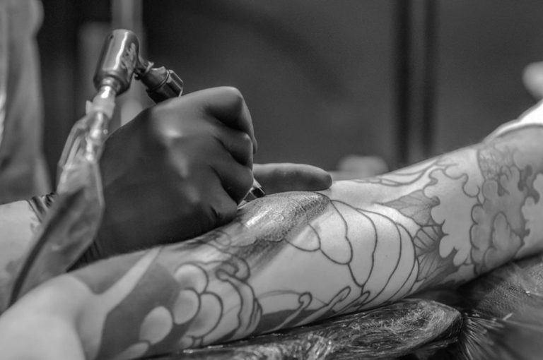 Laserowe usuwanie tatuaży i zalety z tym związane